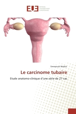 Le carcinome tubaire - Image principale