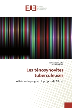 Les ténosynovites tuberculeuses - Image principale