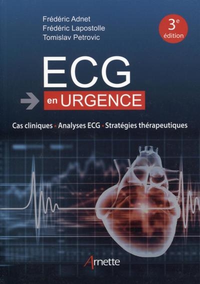 Ecg en urgence - Image principale
