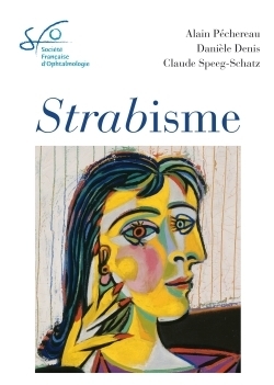 Strabisme - Image principale