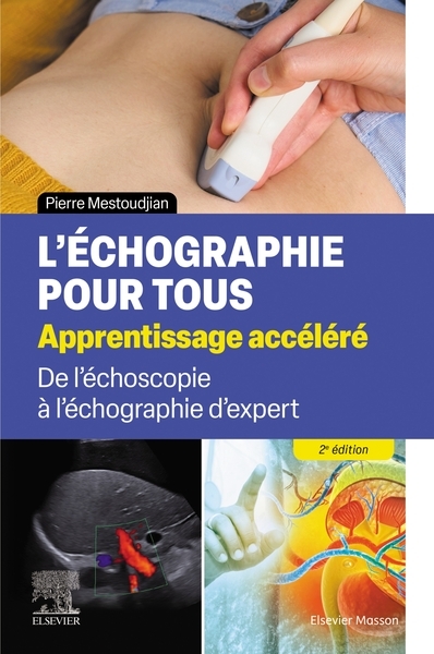 L'échographie pour tous : apprentissage accéléré - Image principale