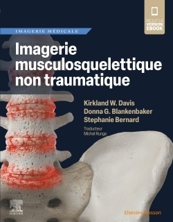 Imagerie musculosquelettique non traumatique - Image principale