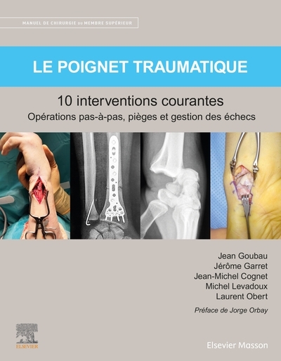 Le poignet traumatique 10 interventions courantes - Image principale