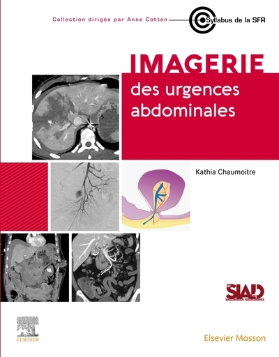 Imagerie des urgences abdominales - Image principale