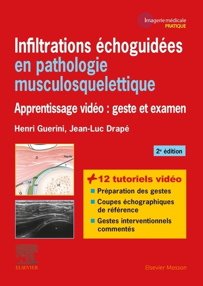 Infiltrations échoguidées en pathologie musculosquelettique - Image principale