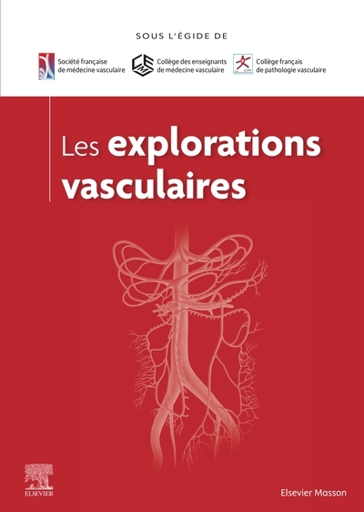 Les explorations vasculaires - Image principale