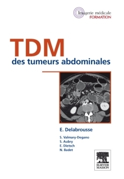 Tdm des tumeurs abdominales - Image principale