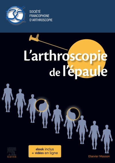 L'arthroscopie de l'épaule - Image principale
