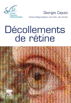 Décollements de rétine - Image principale
