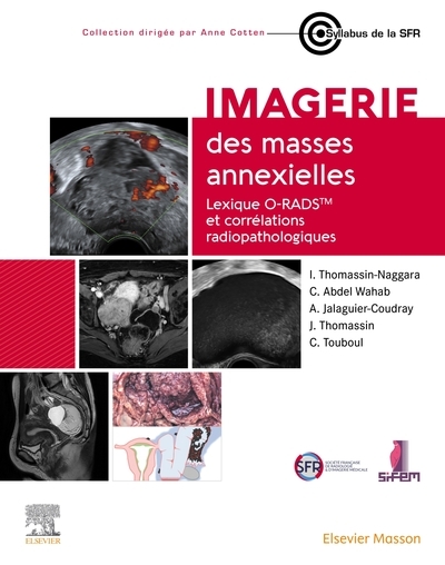Imagerie des masses annexielles - Image principale