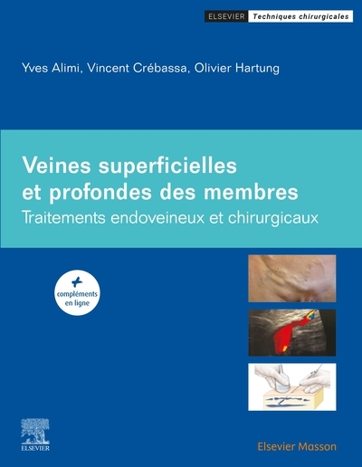 Veines superficielles et profondes des membres - Image principale
