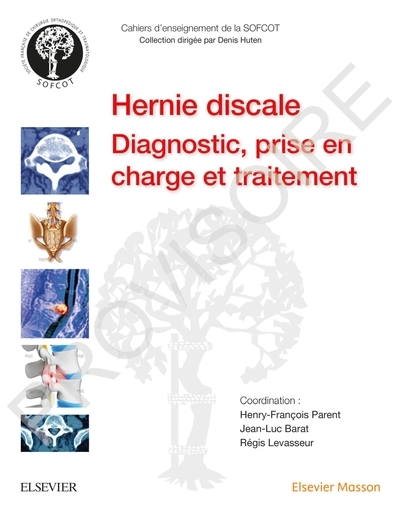 La hernie discale lombaire - Image principale