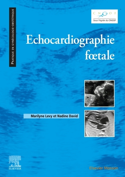 Echocardiographie foetale - Image principale