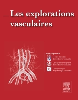 Les explorations vasculaires - Image principale