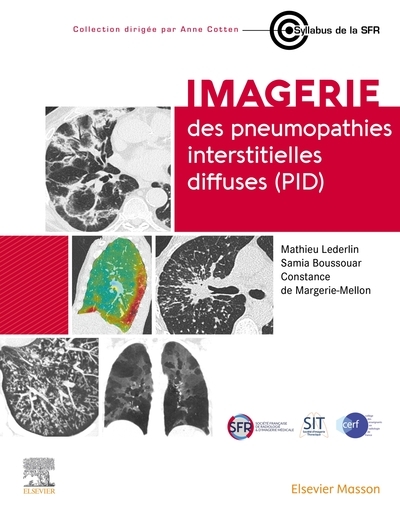 Imagerie des pneumopathies interstitielles diffuses (pid) - Image principale