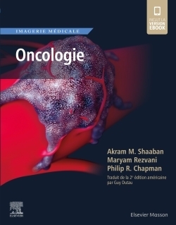 Imagerie médicale : oncologie - Image principale