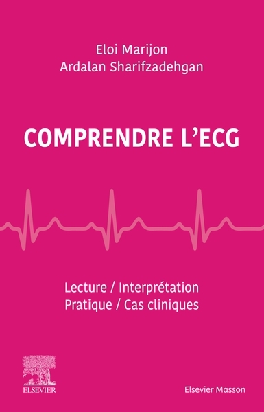 Comprendre l'ecg - Image principale