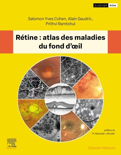 Rétine : atlas des maladies du fond d'oeil - Image principale