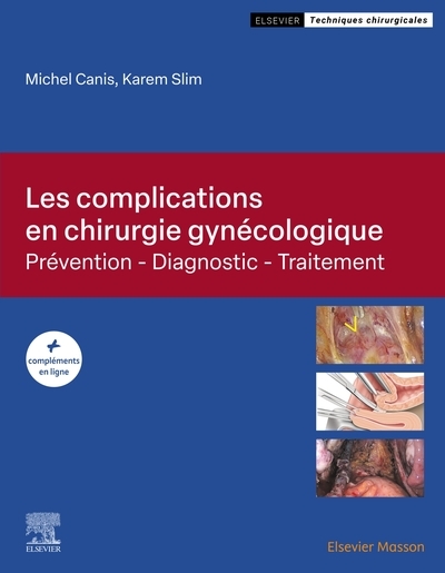 Les complications en chirurgie gynécologique - Image principale
