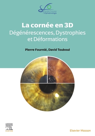 La cornée en 3d : dégénérescences, dystrophies et déformations cornéennes - Image principale
