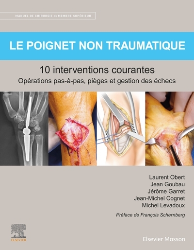 Le poignet non traumatique 10 interventions courantes - Image principale