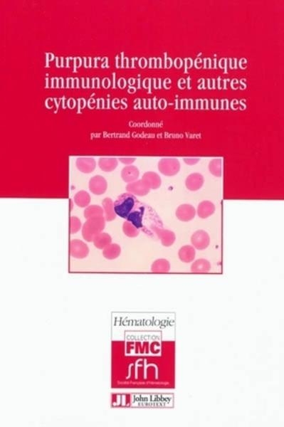 Purpura thrombopénique immunologique et autres cytopénies auto-immunes - Image principale