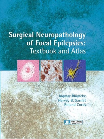 Surgical neuropathology of focal epilepsies - Image principale