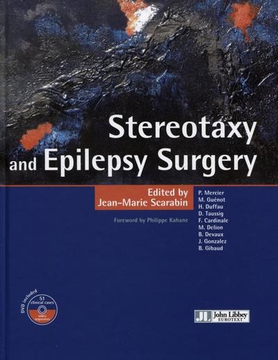 Stereotaxy and epilepsy surgery - Image principale