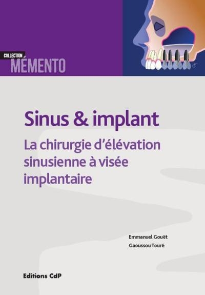 Sinus et implants - Image principale