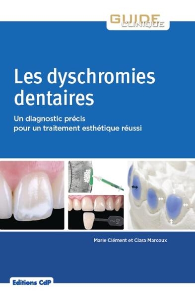 Les dyschromies dentaires - Image principale