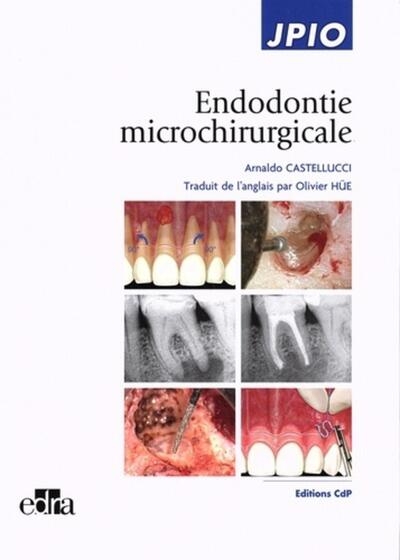 Endodontie microchirurgicale - Image principale