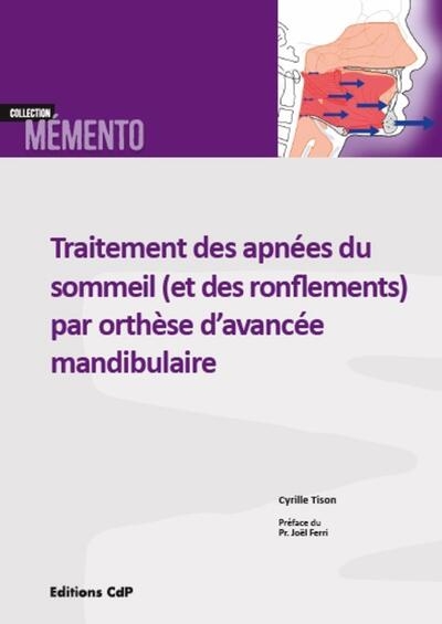 Traitement des apnées du sommeil (et des ronflements) par orthèse d'avancée mandibulaire - Image principale