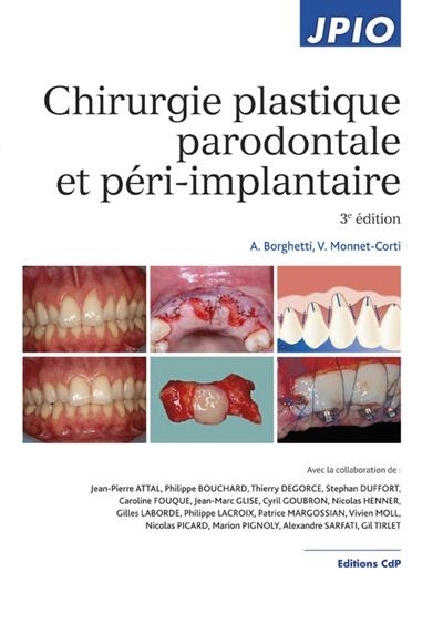Chirurgie plastique parodontale et péri-implantaire - Image principale