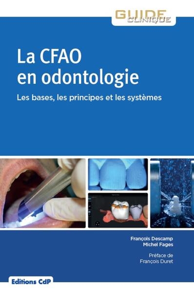 La cfao en odontologie: bases, principes, systèmes - Image principale