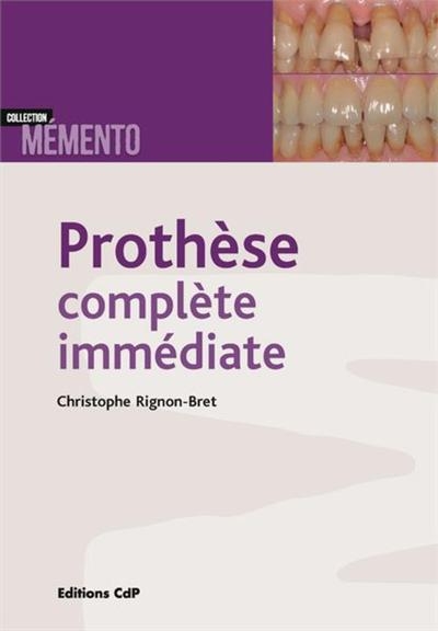 Prothèse complète immédiate - Image principale