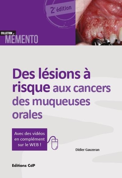 Des lésions à risque aux cancers des muqueuses orales - Image principale