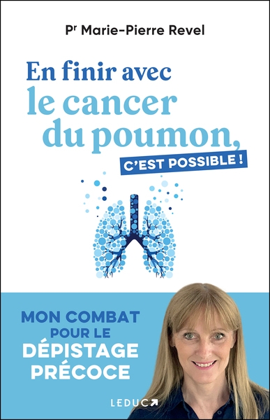En finir avec le cancer du poumon, c'est possible ! - Image principale